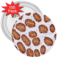 Formalin Paraffin Human Stomach Stained Bacteria Brown 3  Buttons (100 Pack) 