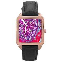 Histology Inc Histo Logistics Incorporated Masson s Trichrome Three Colour Staining Rose Gold Leather Watch  by Mariart