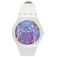 Histology Inc Histo Logistics Incorporated Human Liver Rhodanine Stain Copper Round Plastic Sport Watch (m)